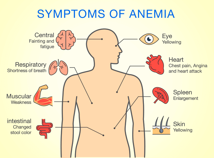 Anemia Symptoms Infographic