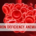 Iron Deficiency Anemia Causes, Symptoms and Treatments