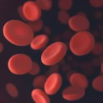 Microcytic Anemia | Types, Diagnosis and Treatments