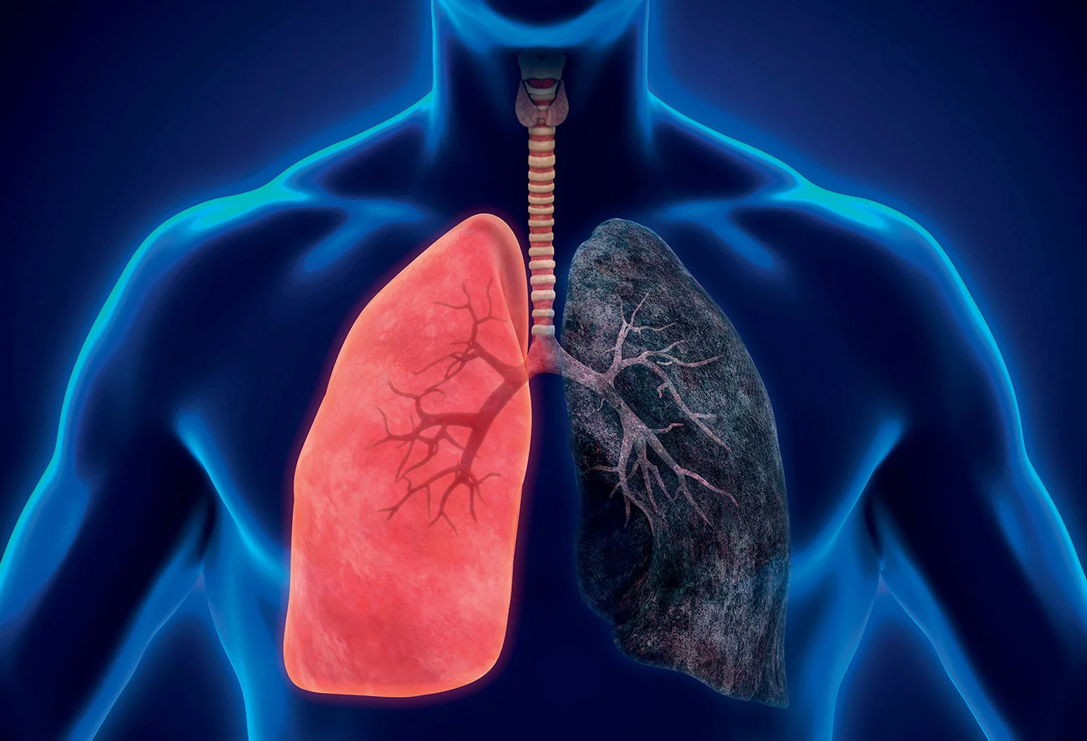 Asbestosis | Causes, Symptoms, and Treatments