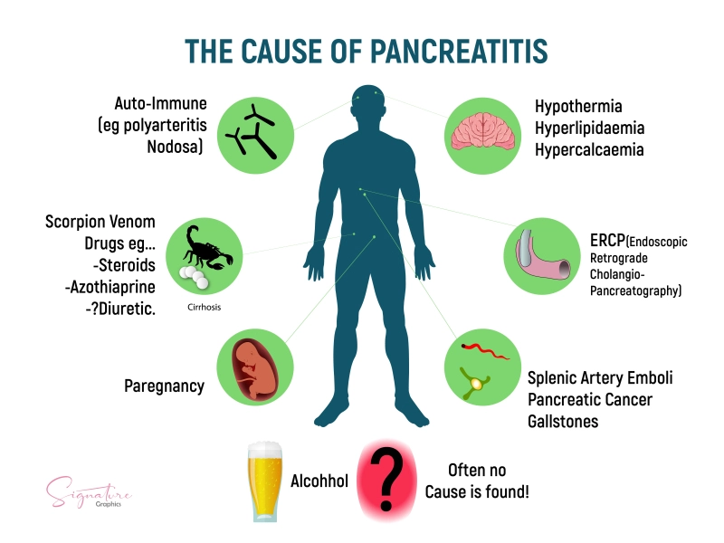 Causes of Acute Pancreatitis