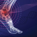 Rheumatoid Arthritis | Symptoms, Causes, Diagnosis & Treatments