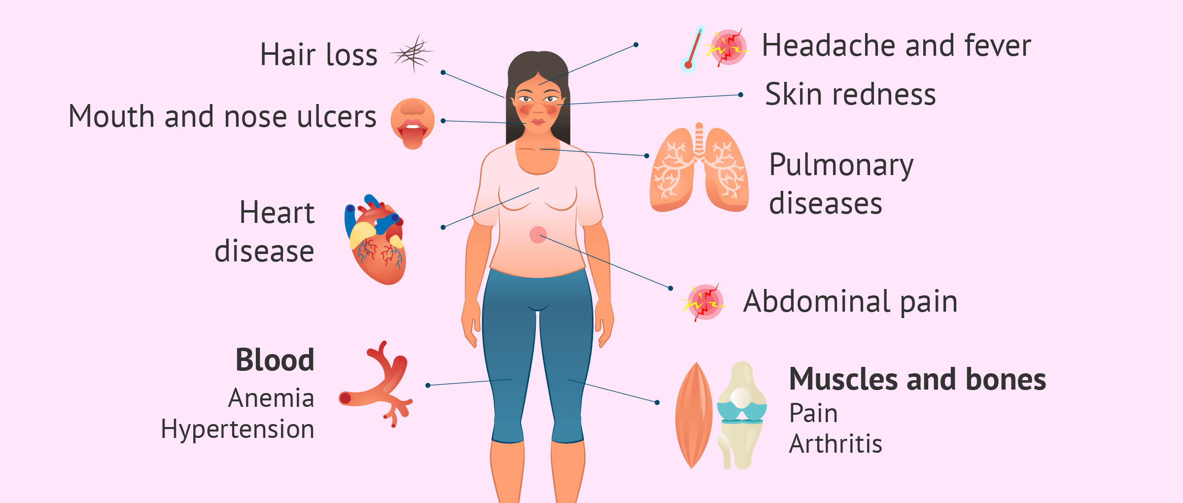Symptoms of Systemic Lupus Erythematosus