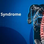 SAPHO Syndrome | Causes, Symptoms, Diagnosis & Treatments
