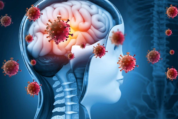 Symptoms of Early-Stage Meningitis