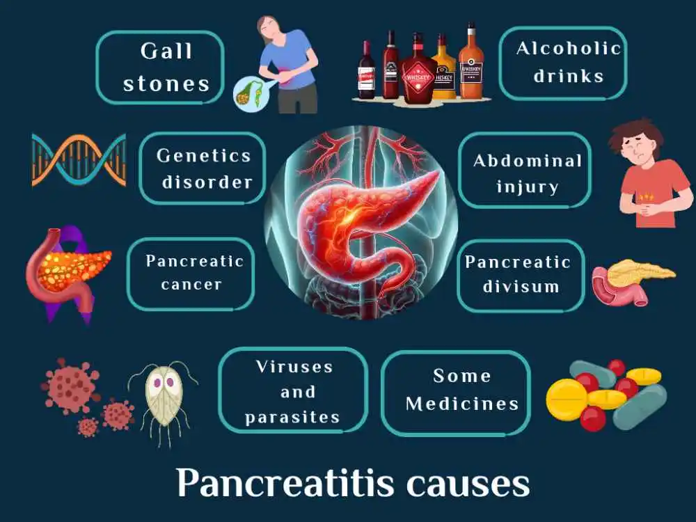 pancreasitis when to worry if you have gallstones or suffer from pancreatic cancer and genetic disorders