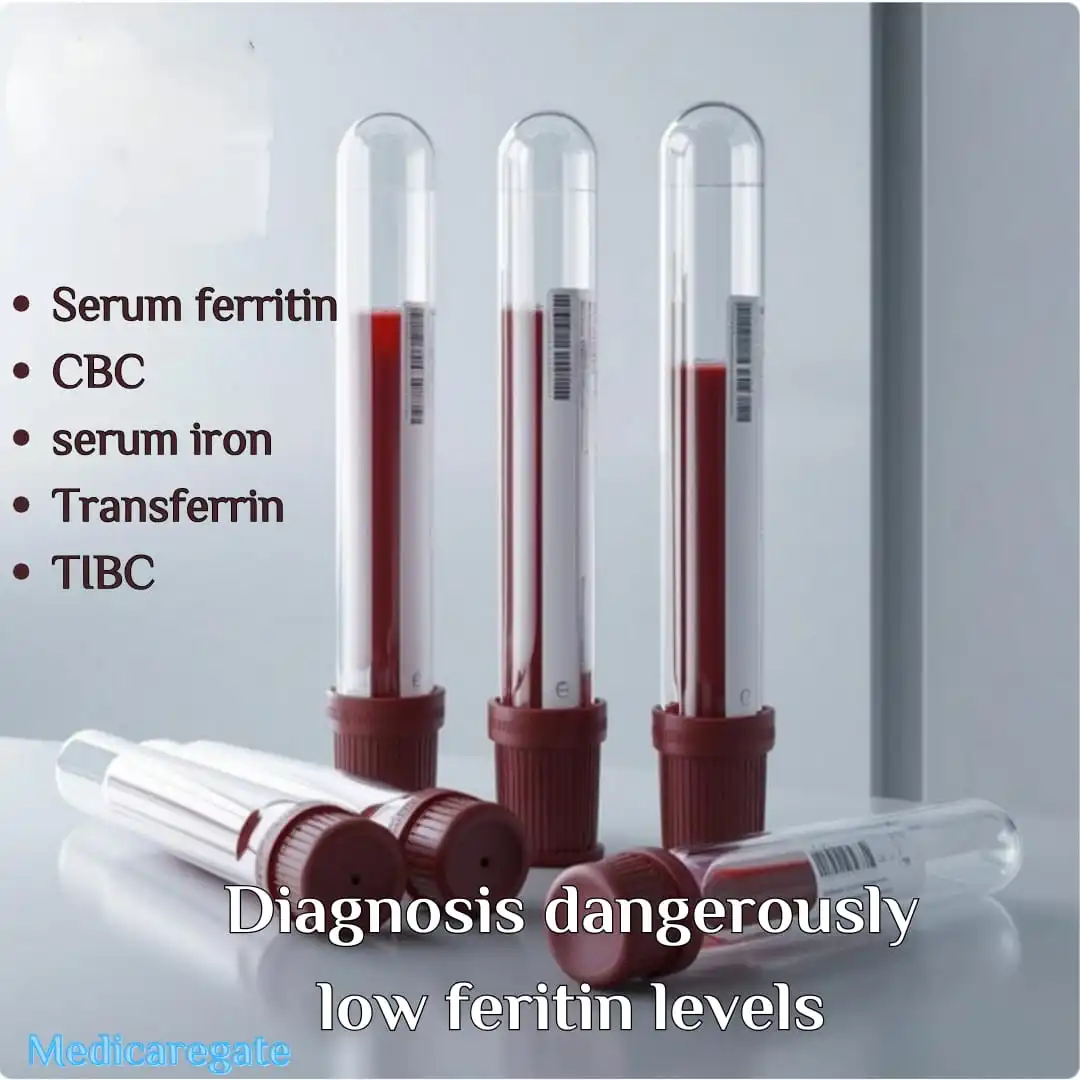 diagnosis of dangerously of low ferritin levels by many tests.