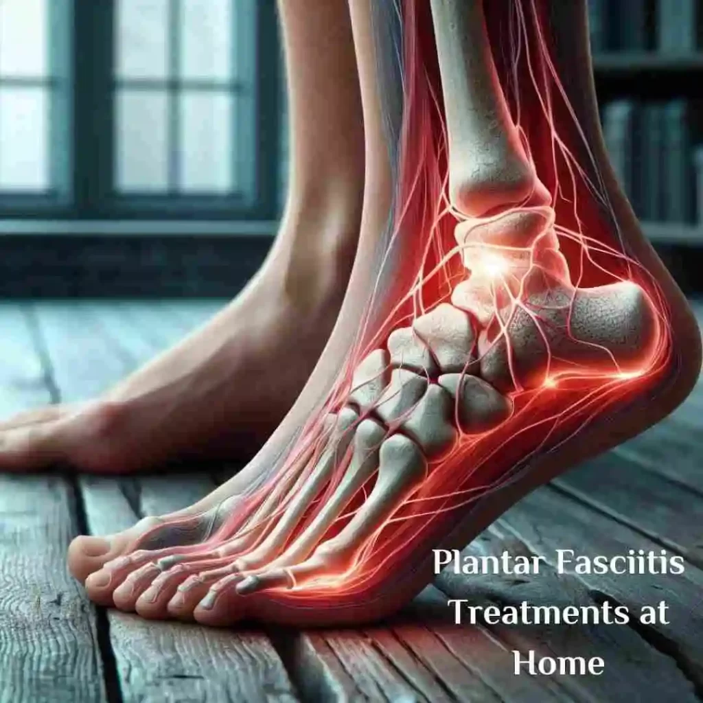 Plantar Fascitis treatments at home