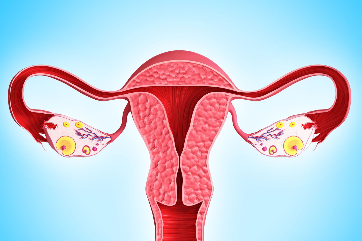 Causes of Heavy Periods