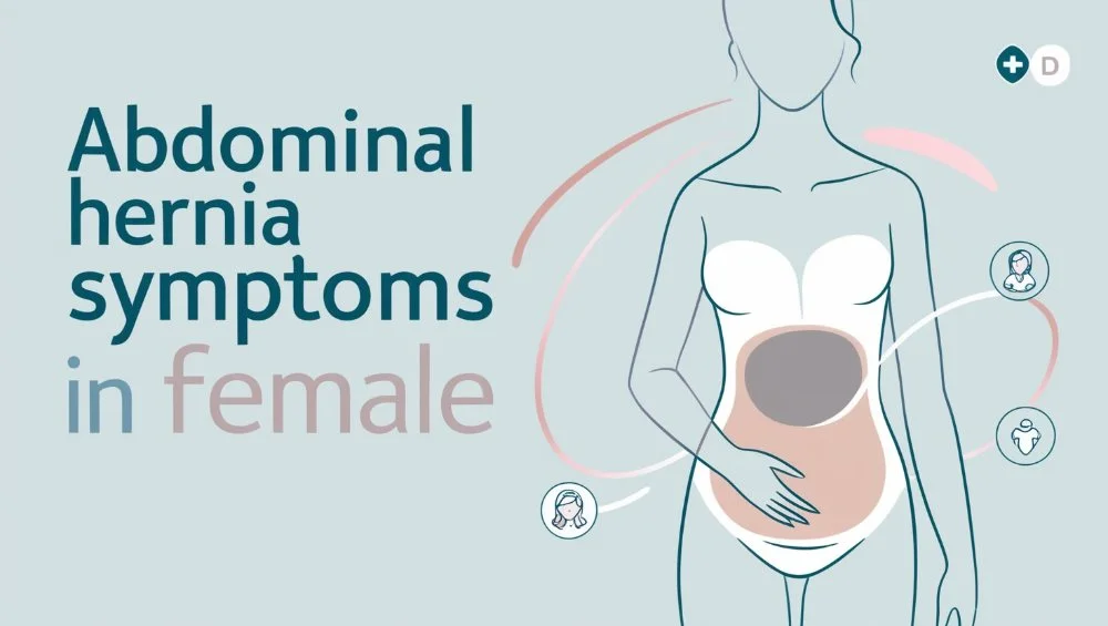 Abdominal Hernia Symptoms in Female