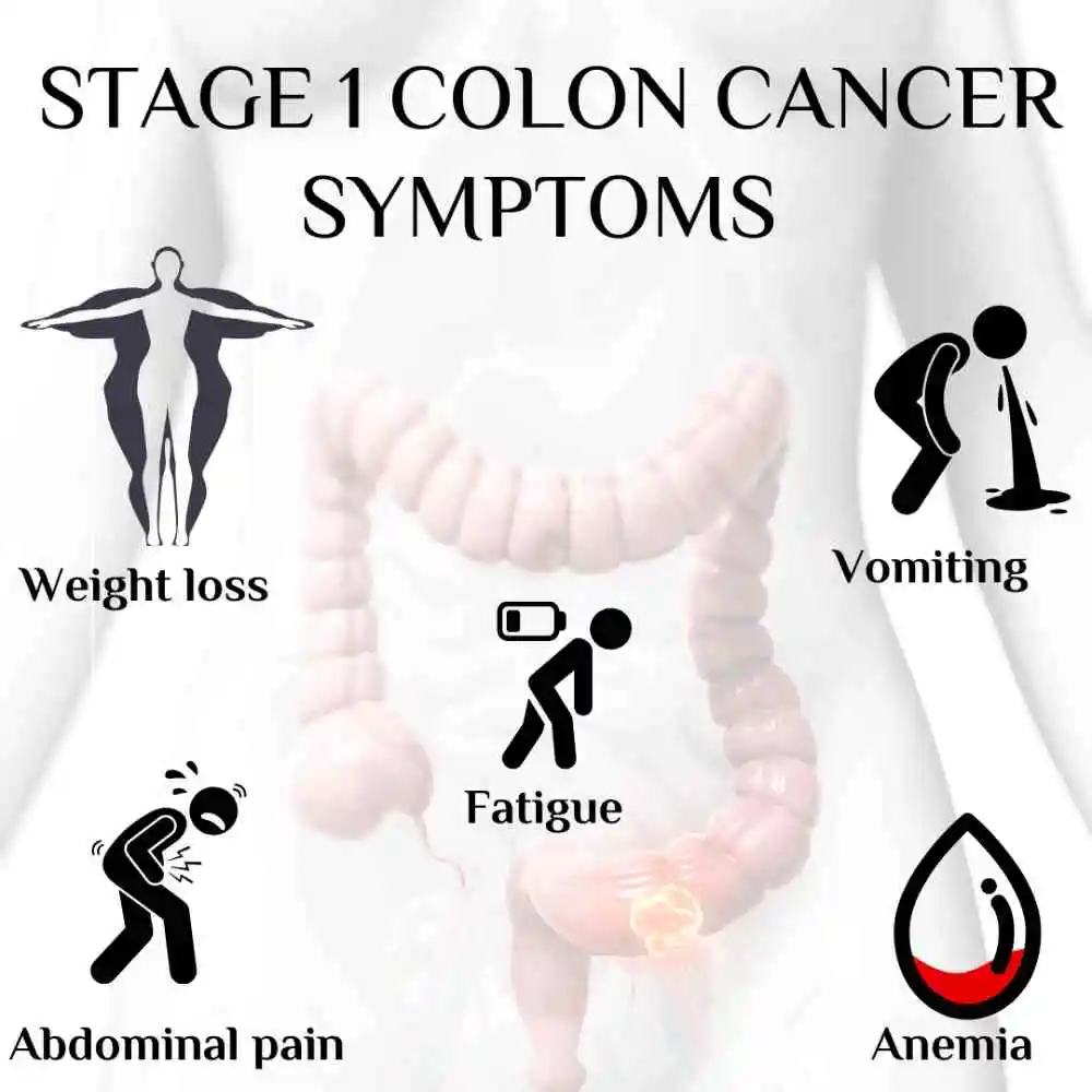 Stage1 colon cancer symptoms including weight loss and vomiting