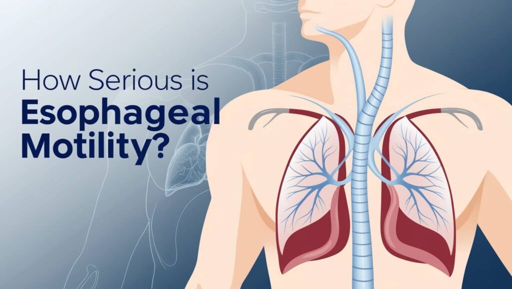 How Serious Is Esophageal Motility(1)
